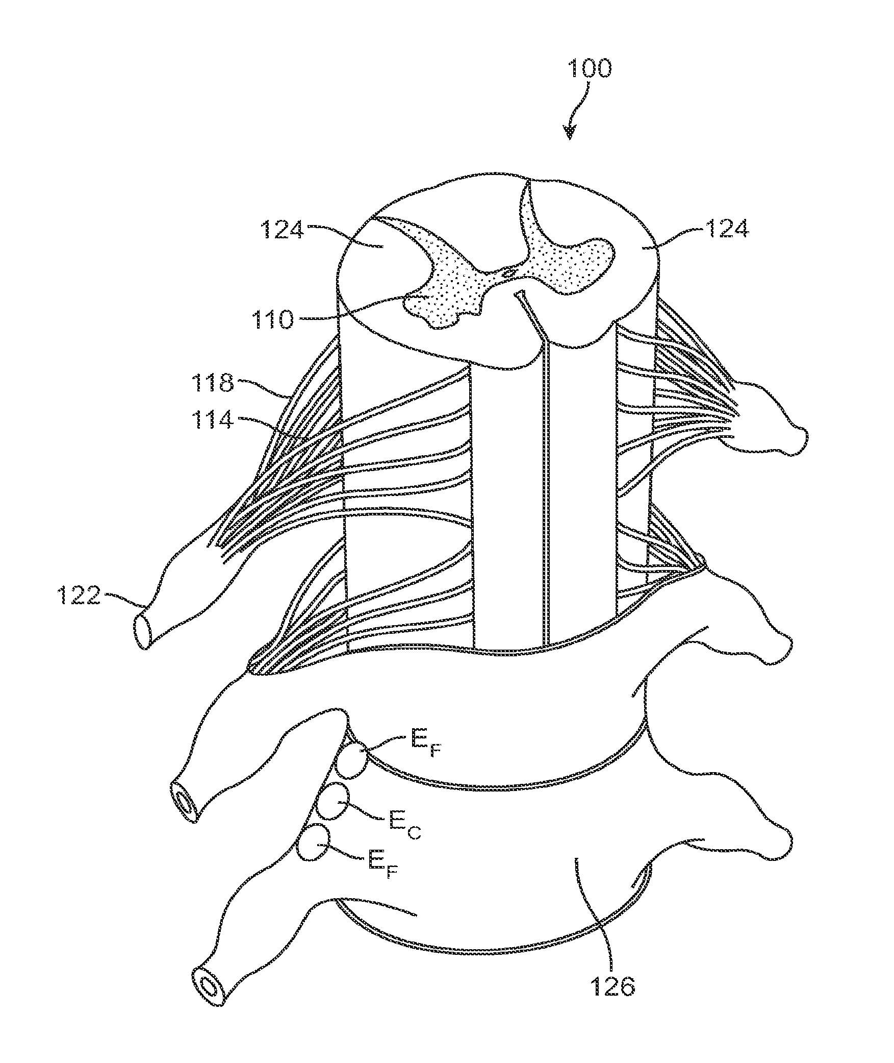 Methods and devices for treatment of non-neuropathic conditions using electrical stimulation