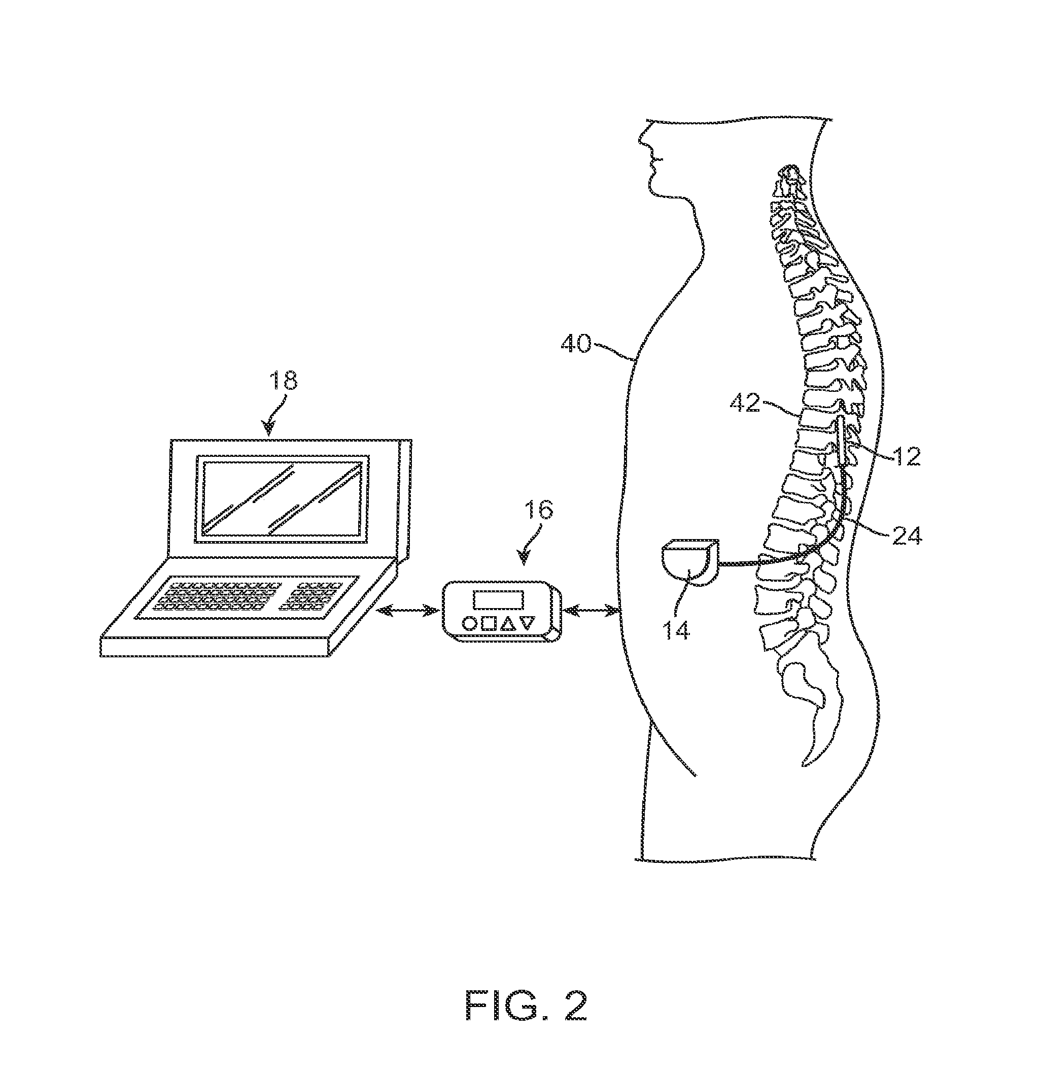 Methods and devices for treatment of non-neuropathic conditions using electrical stimulation