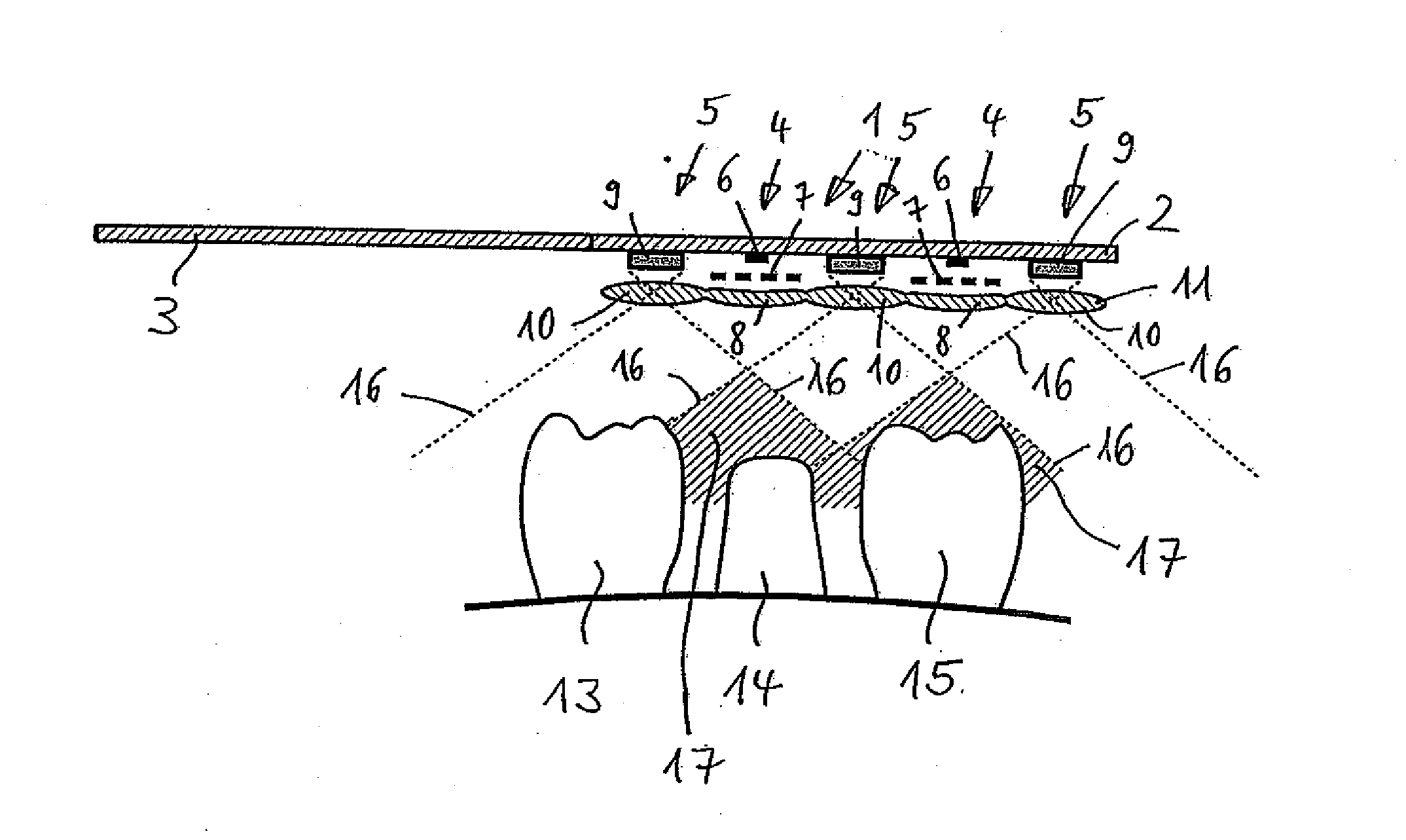 Device for Determining the 3D Coordinates of an Object, In Particular of a Tooth