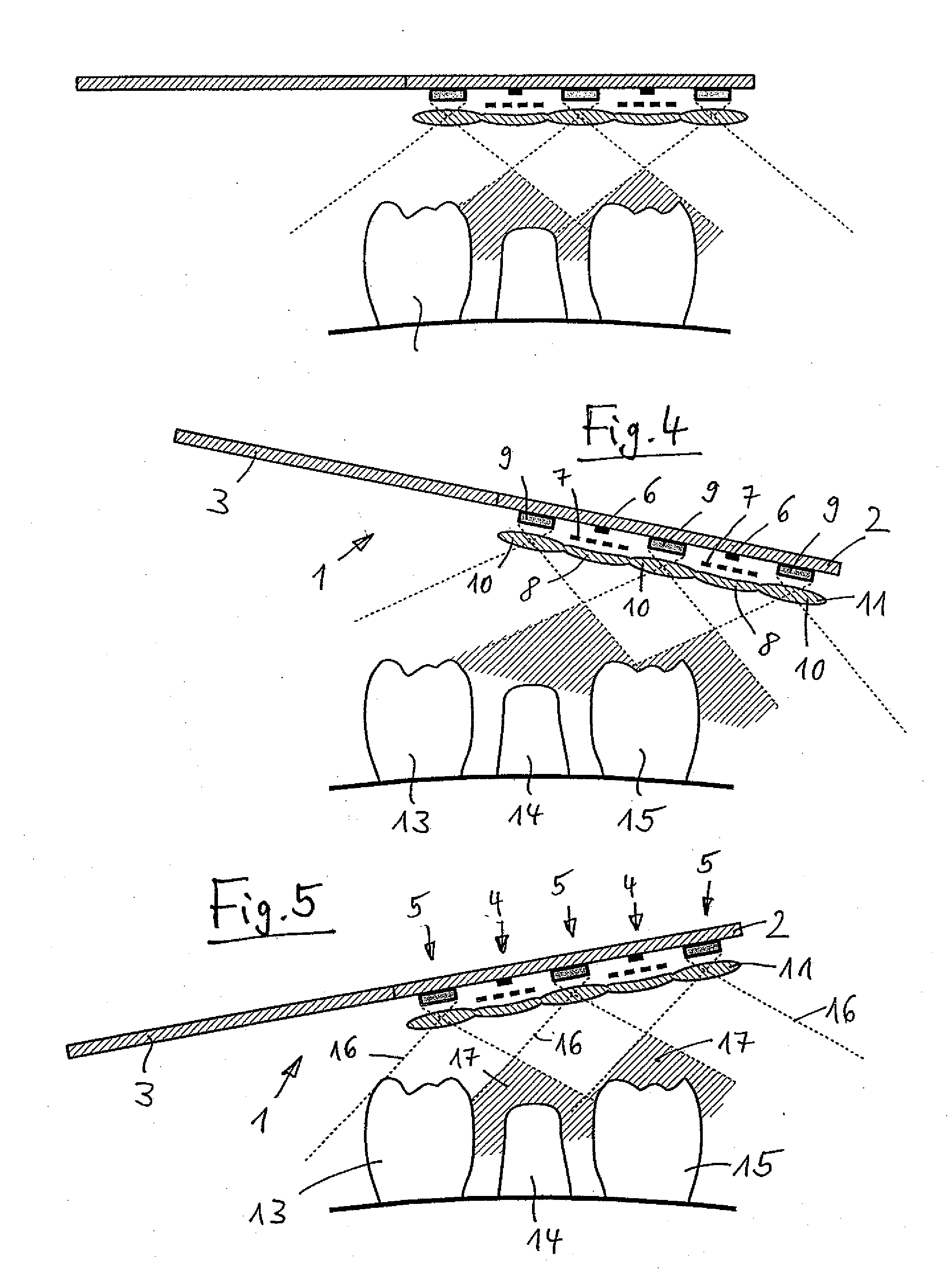 Device for Determining the 3D Coordinates of an Object, In Particular of a Tooth