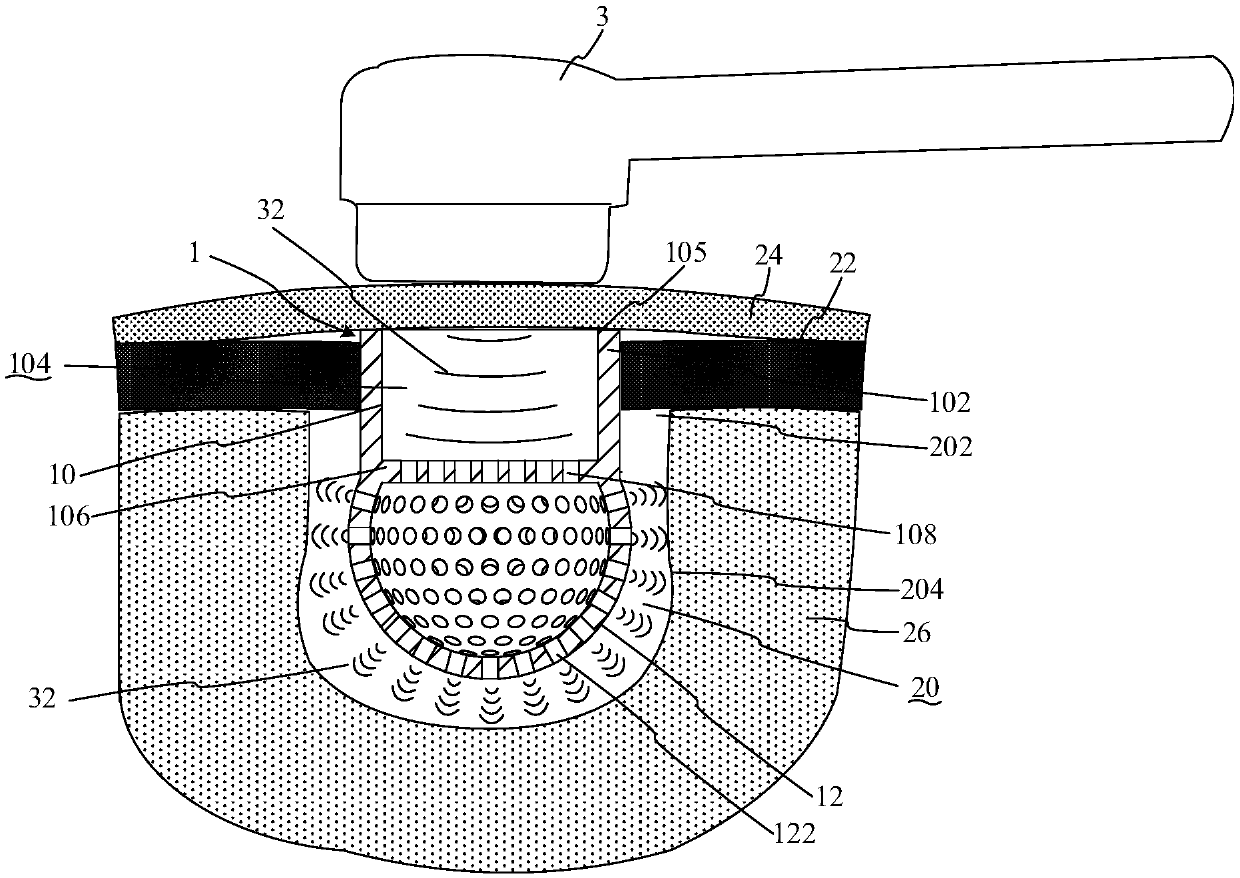 Implantable ultrasonic conduction and drug delivery device