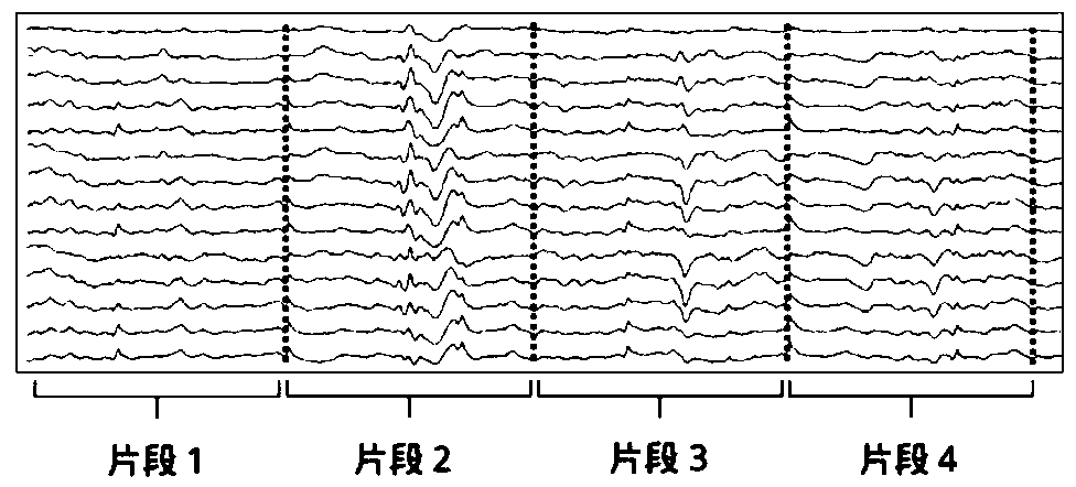 A method for automatic detection of epilepsy magnetoencephalogram spikes and a traceable positioning system