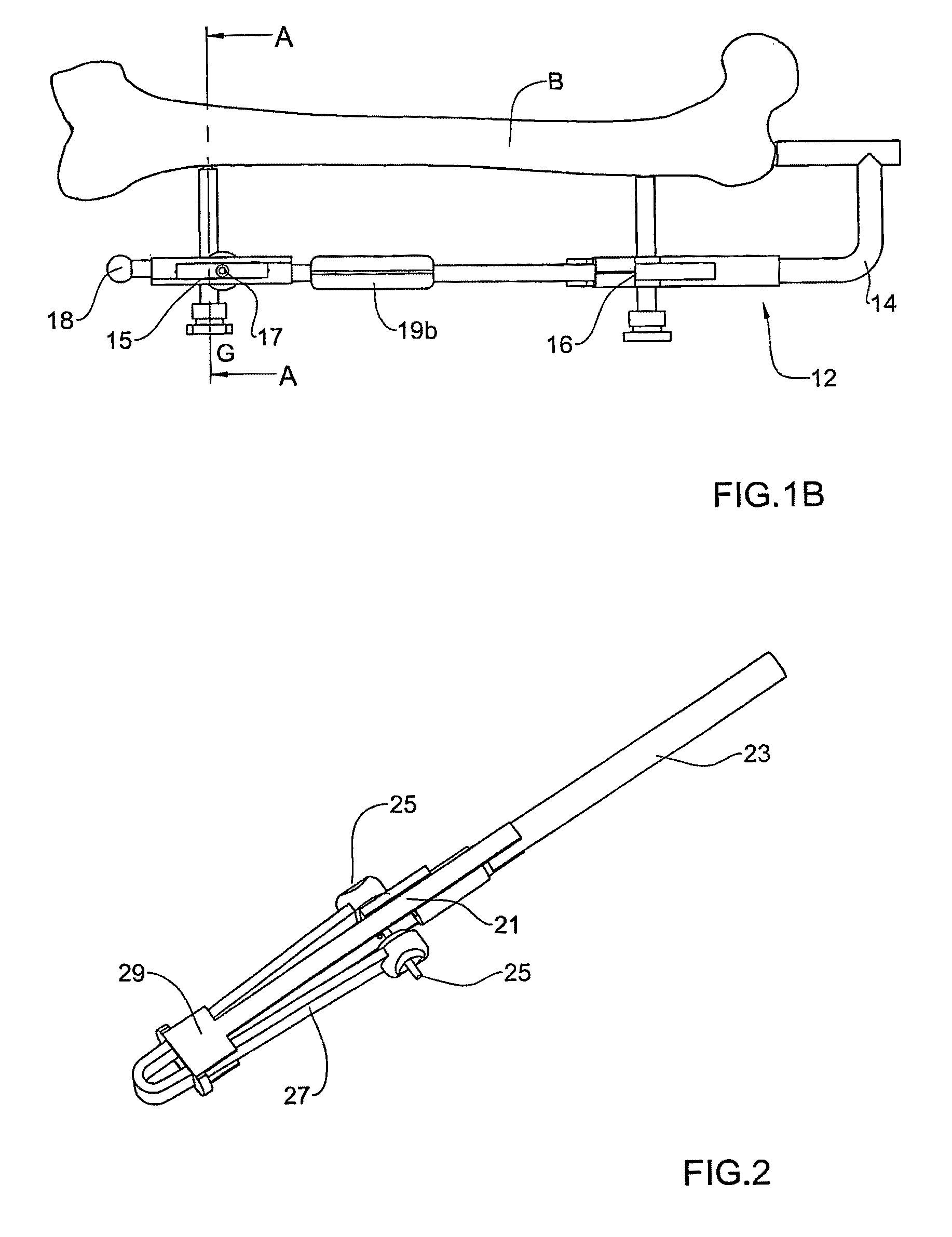 System and method for locating of distal holes of an intramedullary nail
