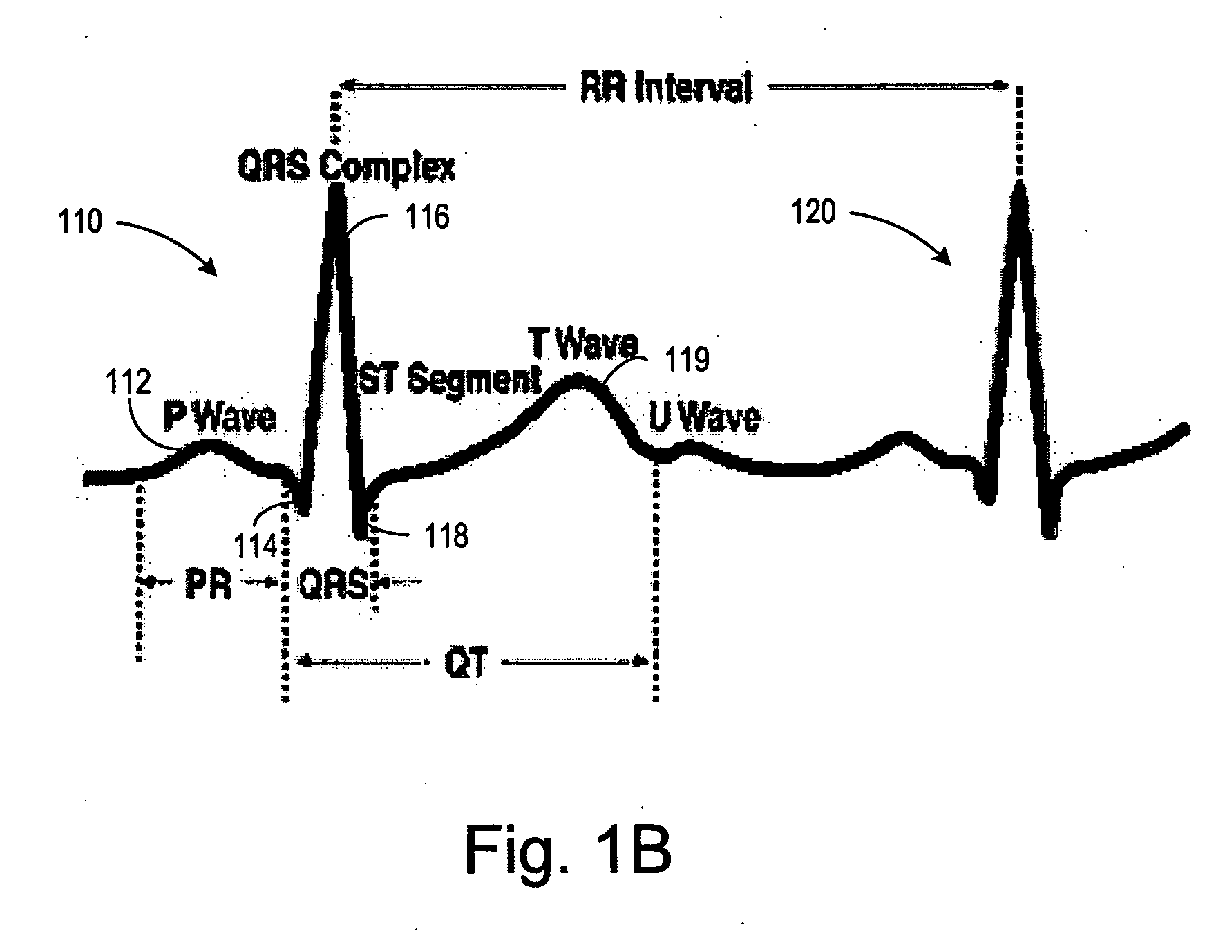 Posture monitoring using cardiac activation sequences