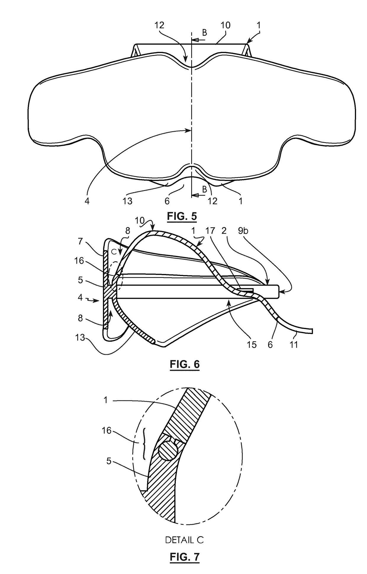 Intraoral device for the repositioning and rehabilitation of the tongue