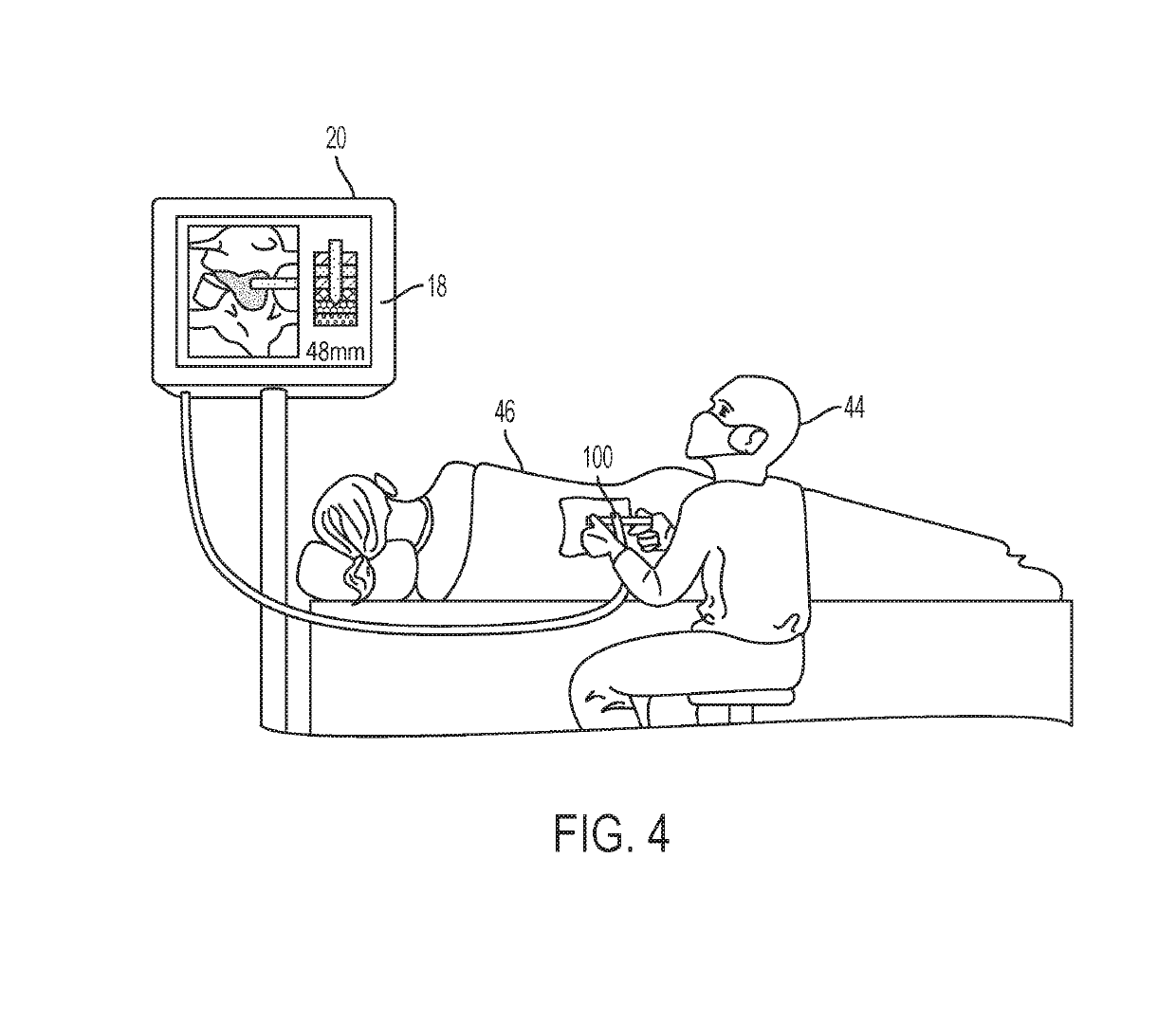 System for generating synthetic aperture ultrasound images during needle placement