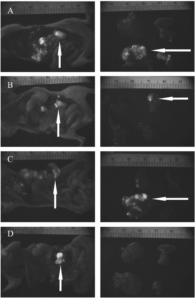 Application of beta-asarone to preparation of drugs for treating or preventing liver metastases of colorectal cancer