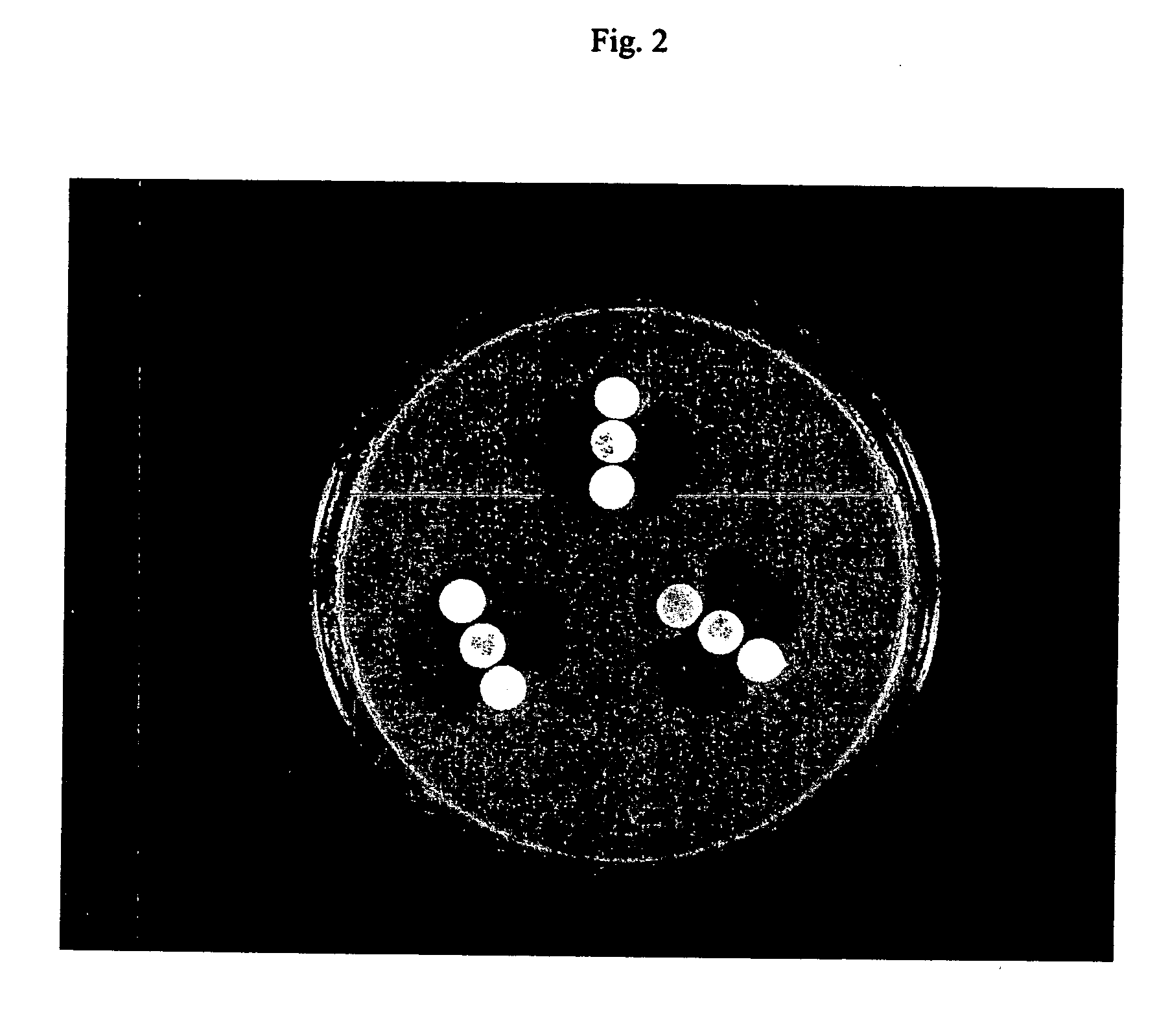 Device and method for detecting antibiotic-inactivating enzymes