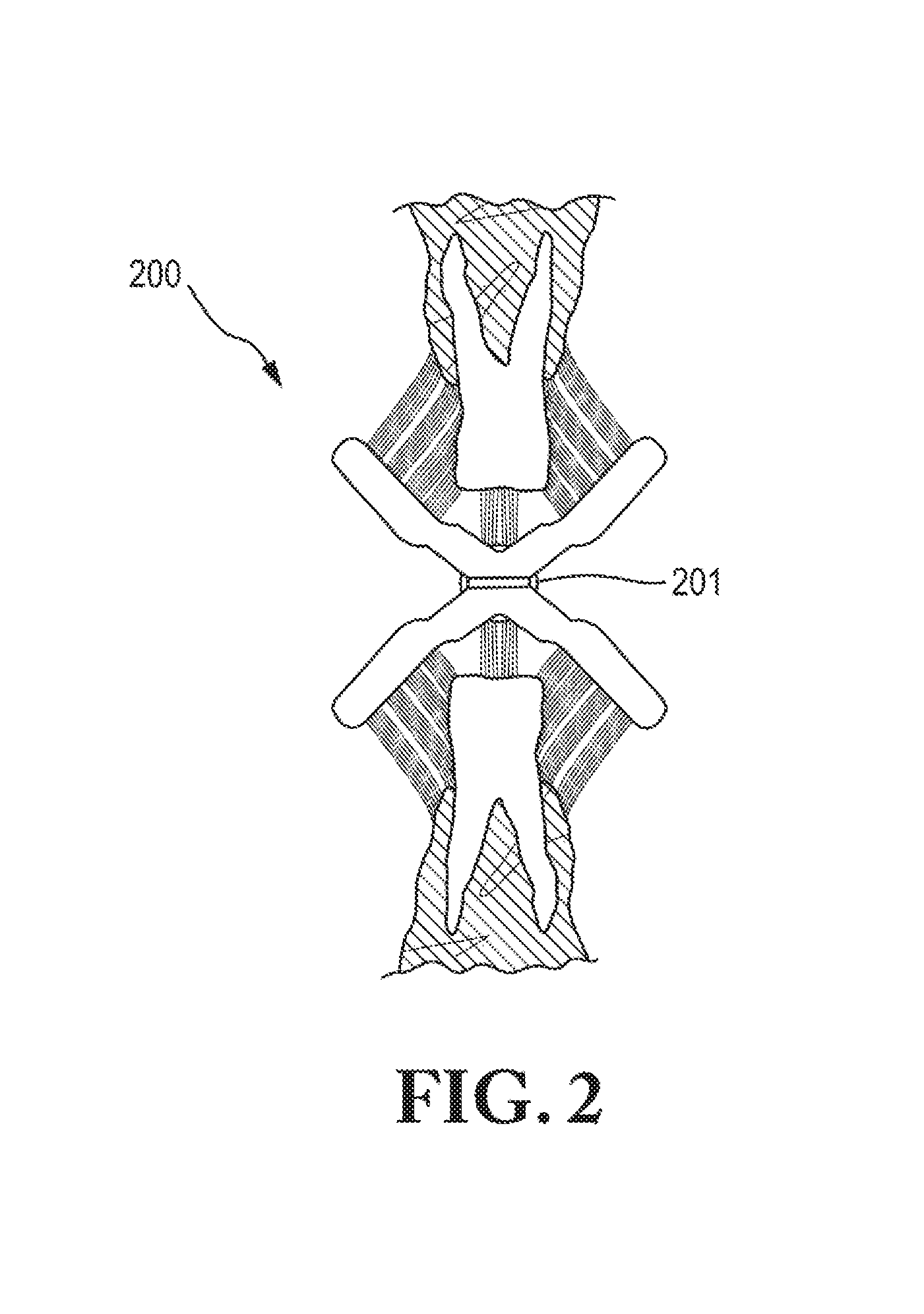 Oral hygiene systems and methods