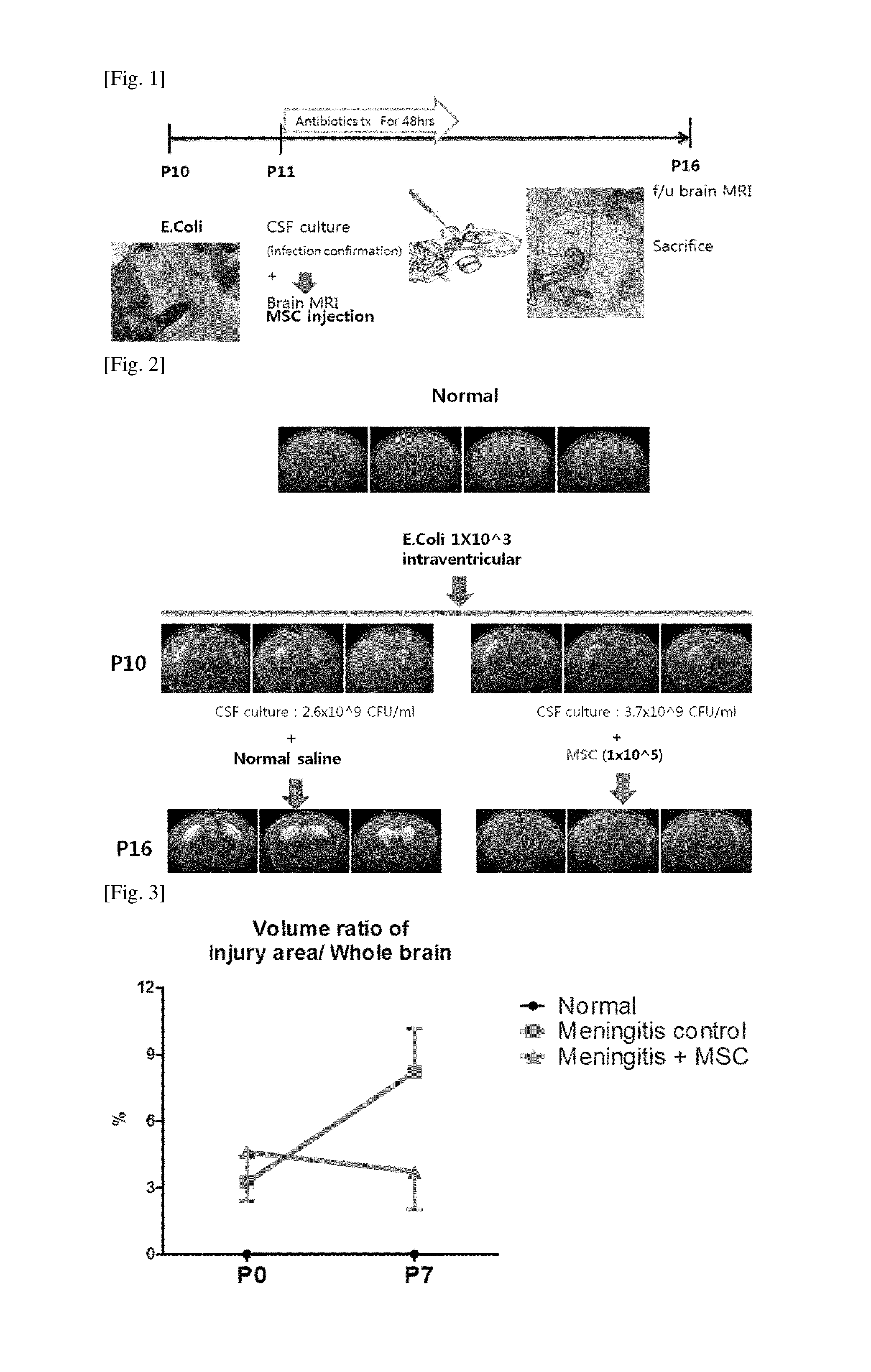 Composition for treating inflammatory brain diseases which includes stem cell as active ingredient