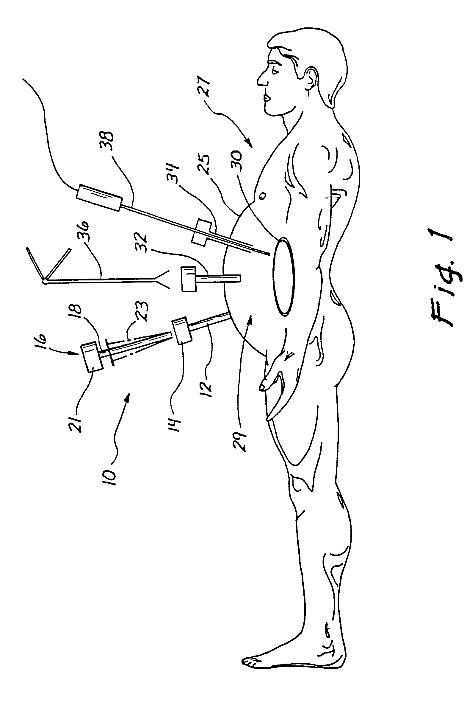 Traction trocar apparatus and method