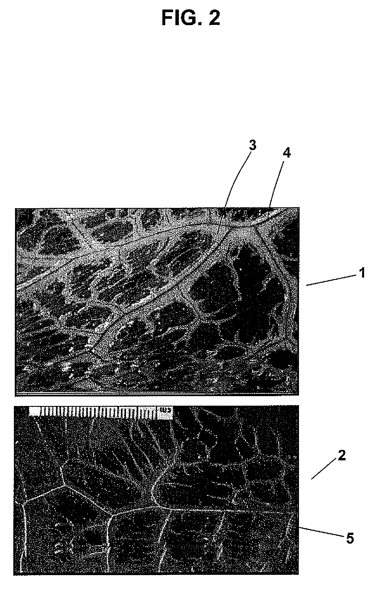 Decellularized omentum matrix and uses thereof