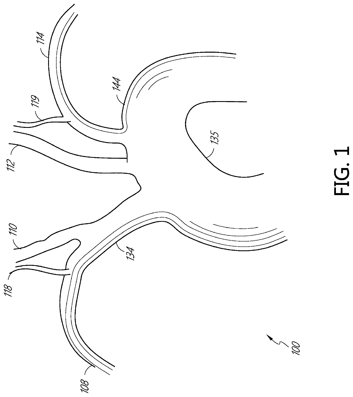 Systems and methods for protecting the cerebral vasculature