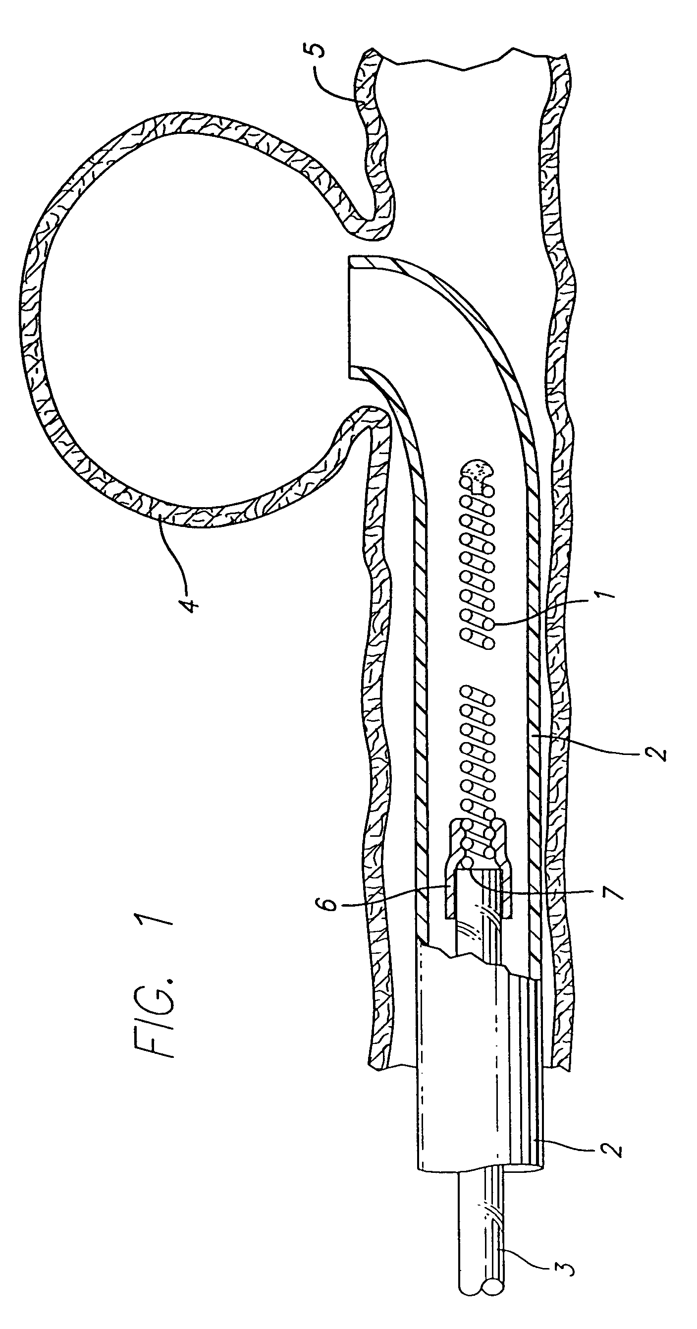 Three dimensional, low friction vasoocclusive coil, and method of manufacture