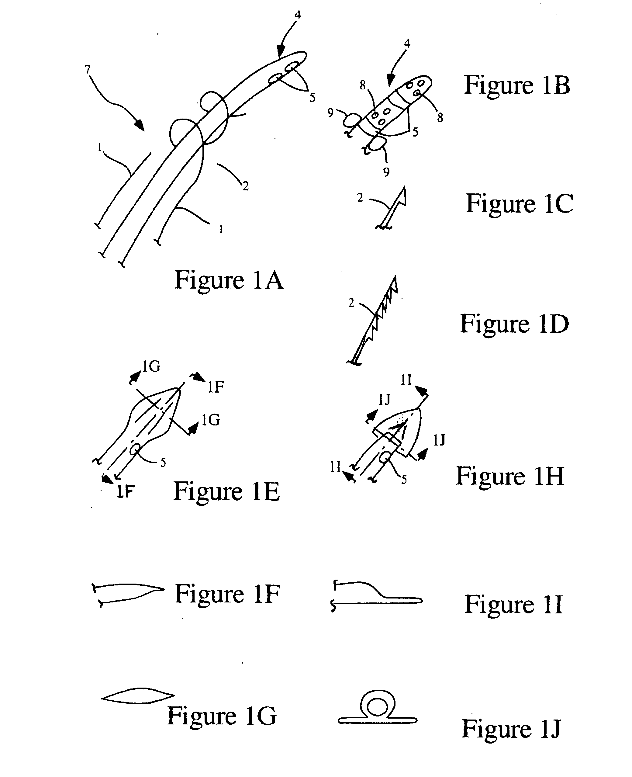 Devices and methods for treating cardiac pathologies