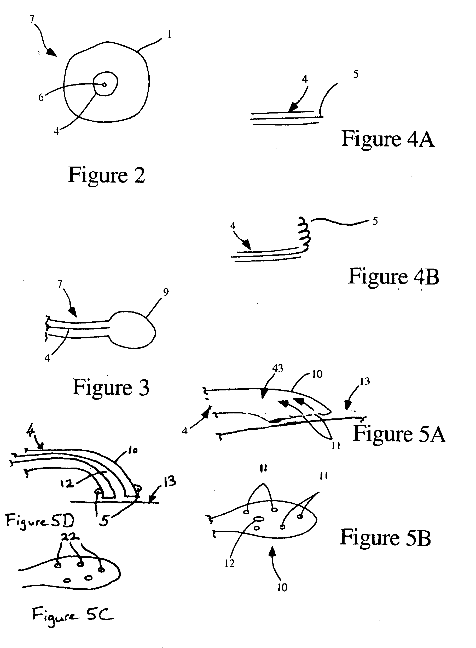 Devices and methods for treating cardiac pathologies
