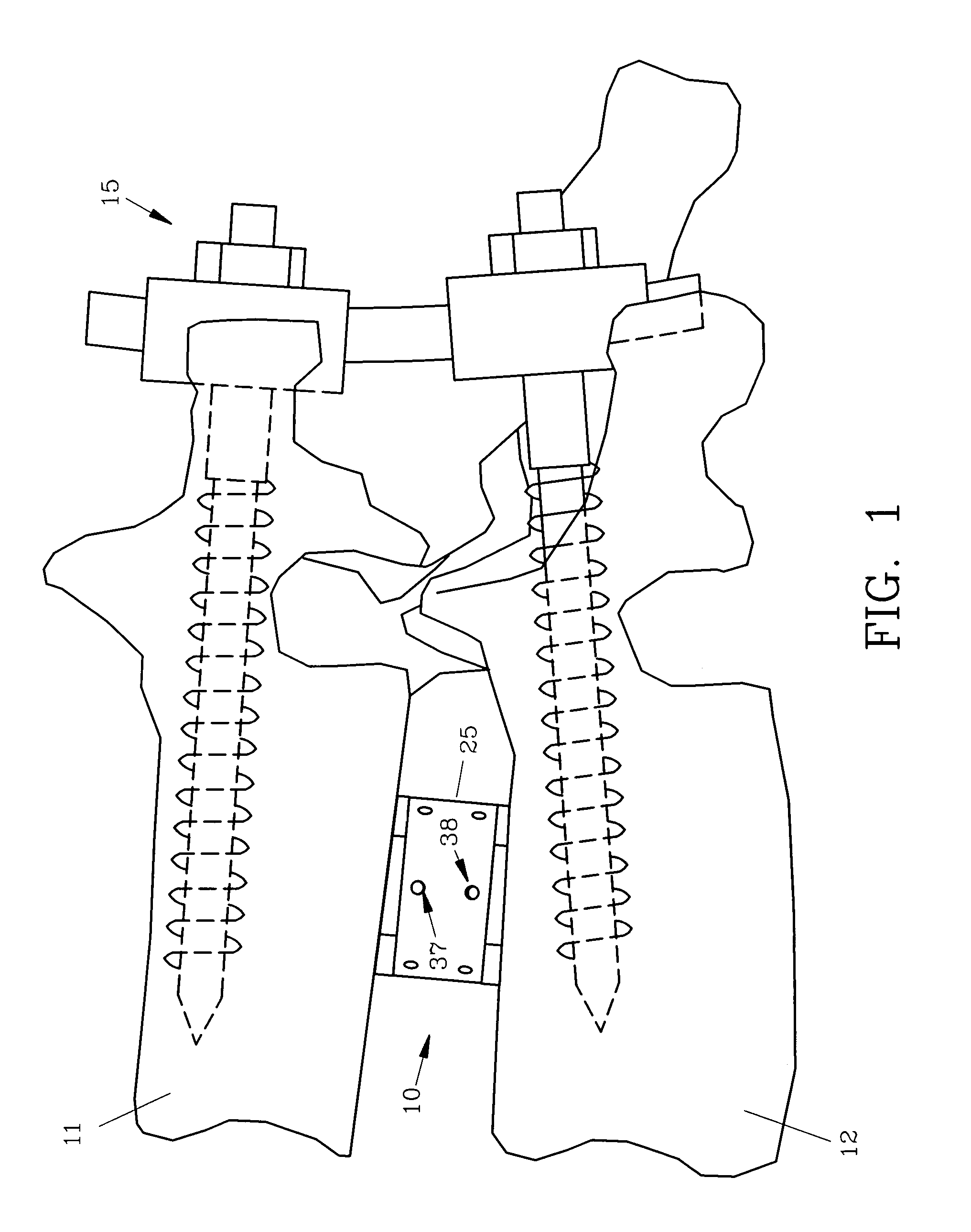 Spinal interbody fusion device and method