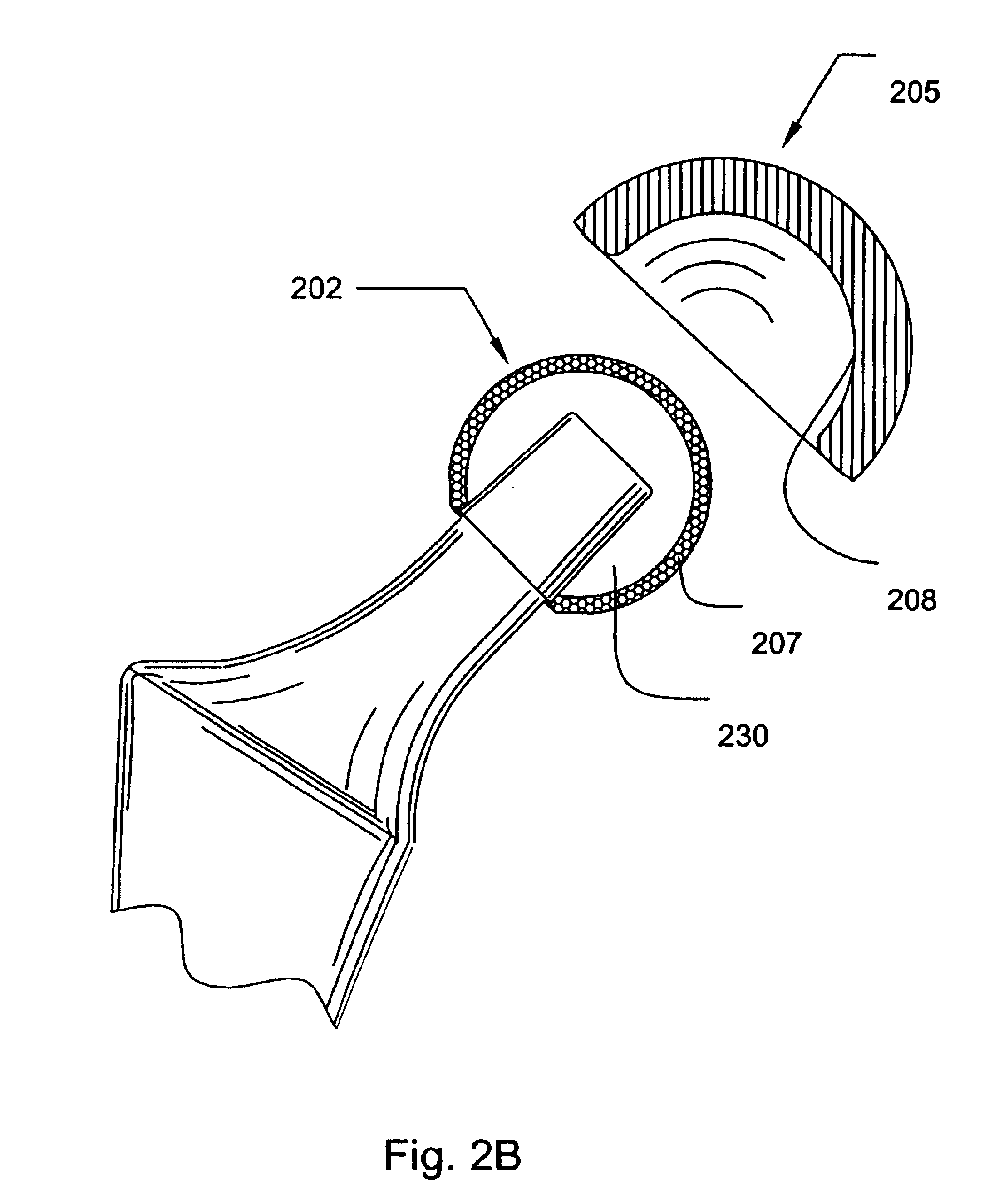 Prosthetic hip joint having a polycrystalline diamond articulation surface and a plurality of substrate layers