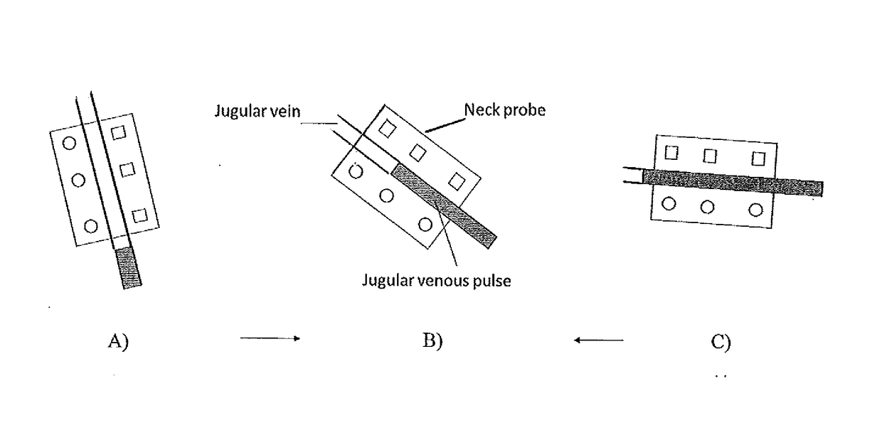 System and method for non-invasive monitoring of central venous pressure