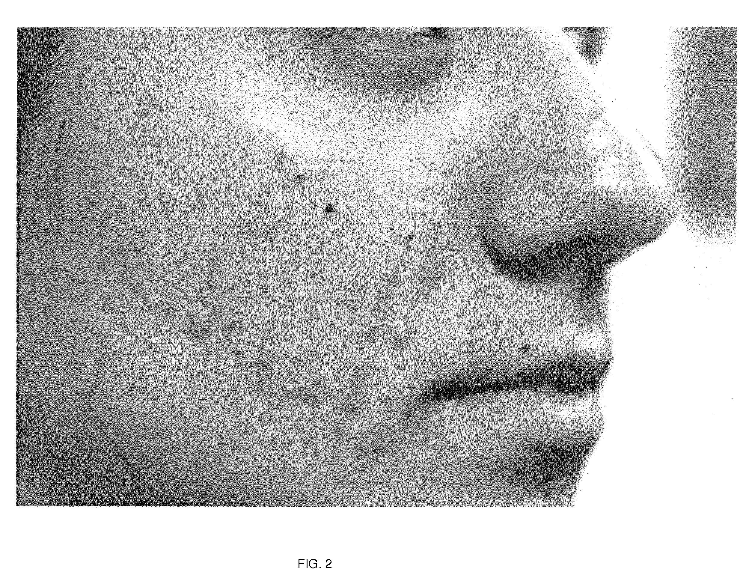 Method to treat and prevent skin diseases with Porifera-based therapeutic compositions treating and preventing skin diseases