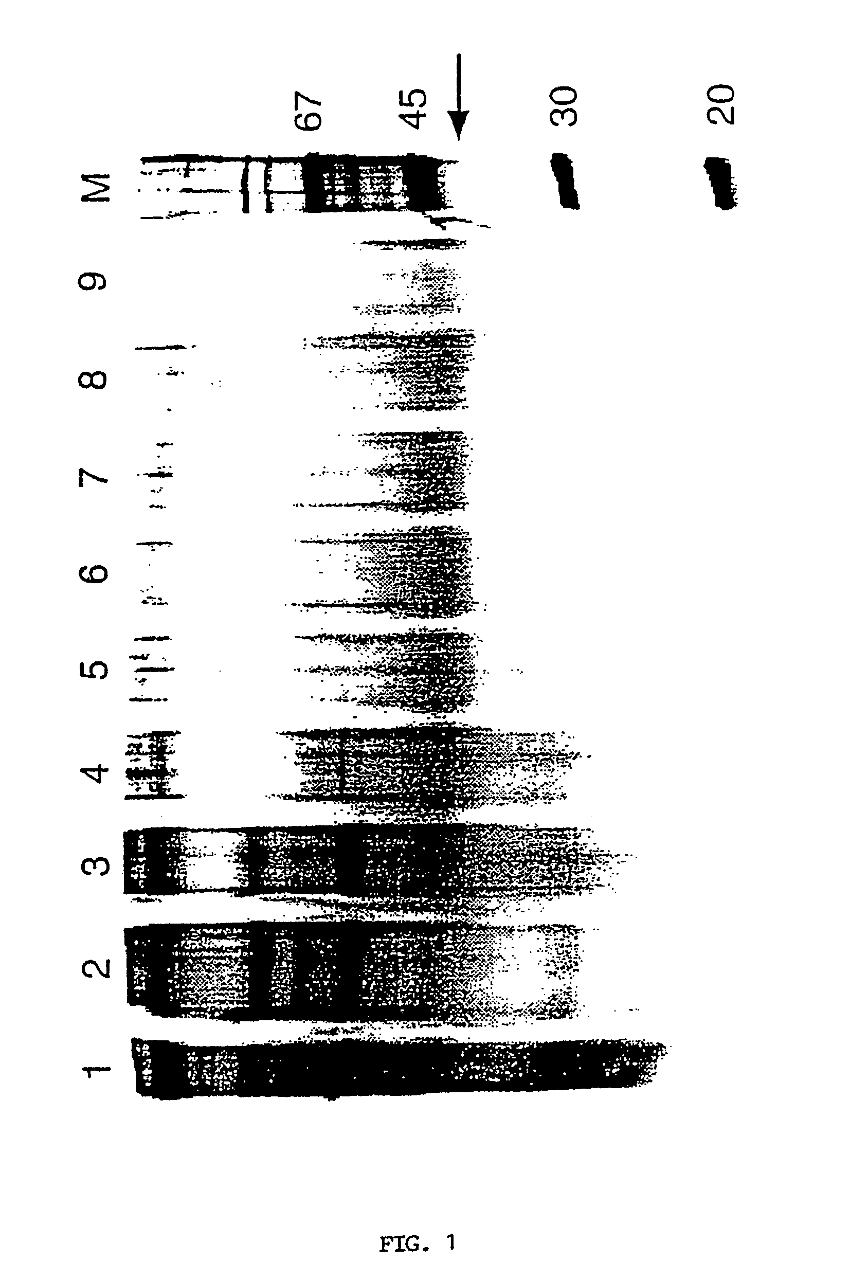 Interleukin-18 binding proteins, their preparation and use for the treatment of sepsis