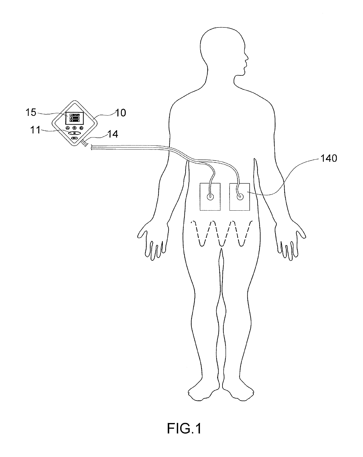 System and method for relieving high blood sugar factor of diabetes