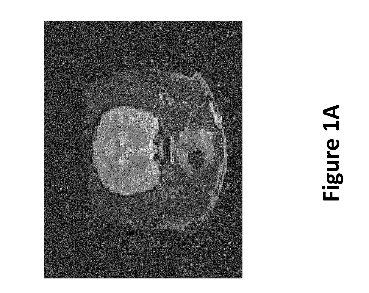 Irreversible electroporation to create tissue scaffolds