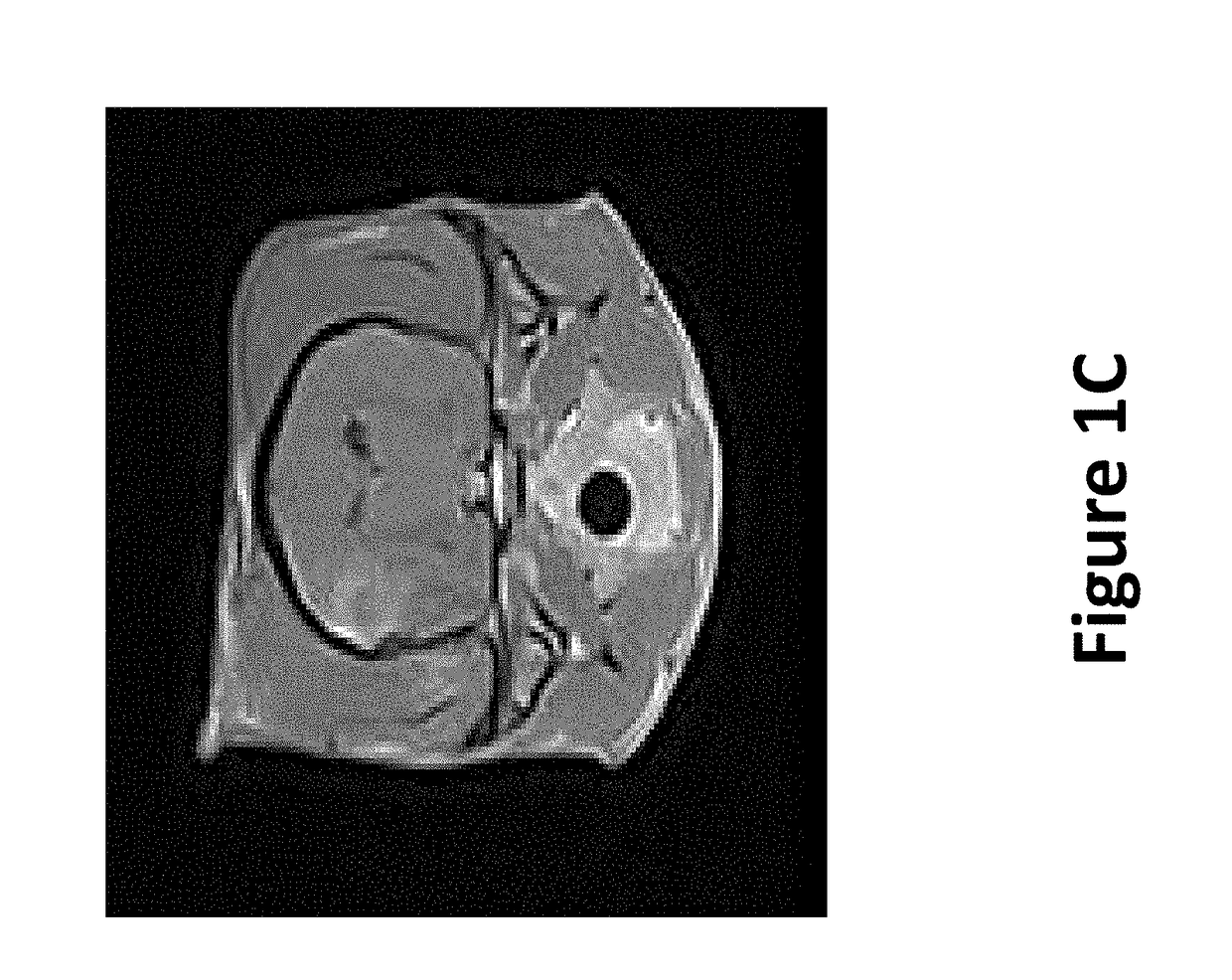 Irreversible electroporation to create tissue scaffolds