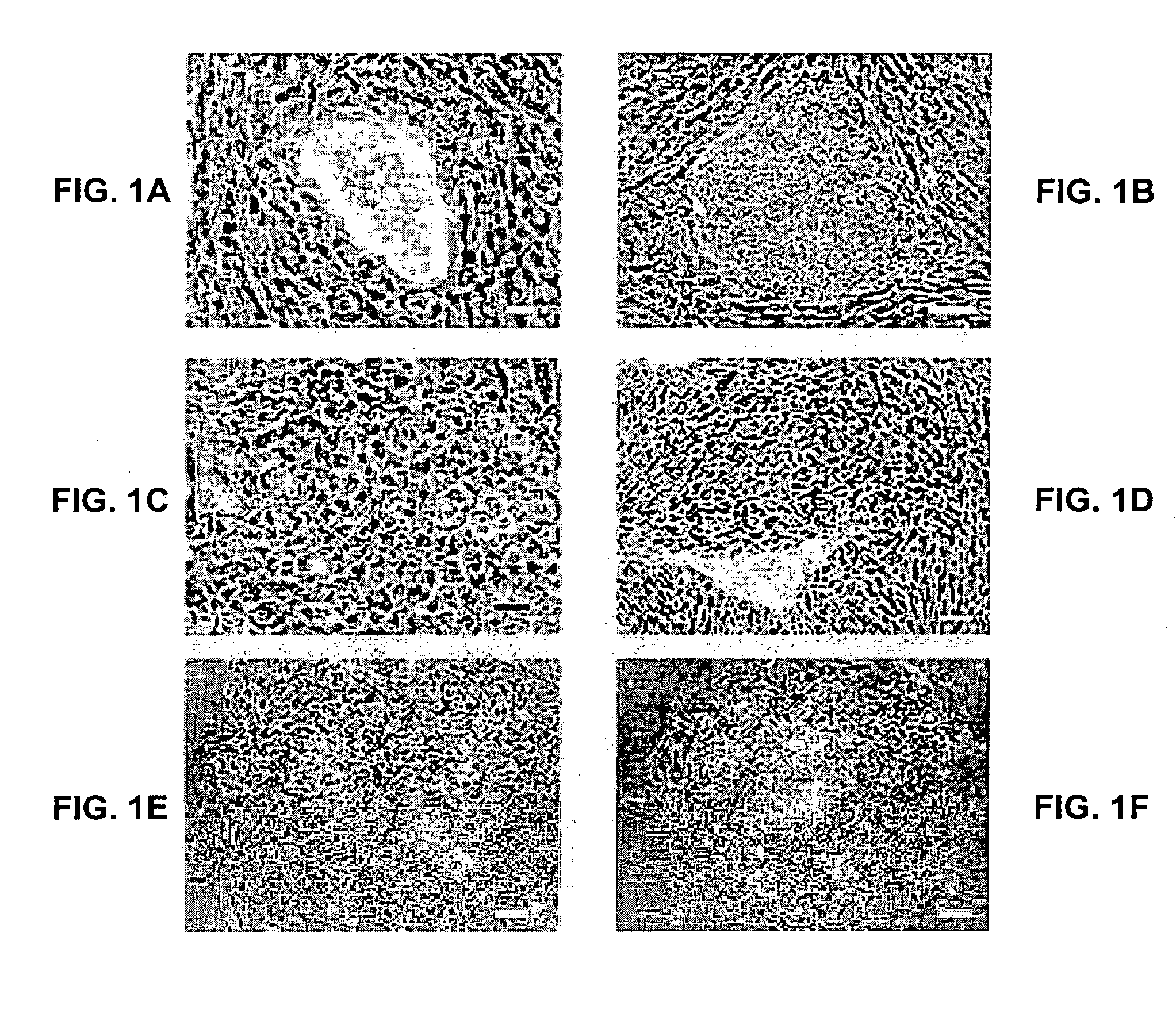 Embryonic stem cells and neural progenitor cells derived therefrom