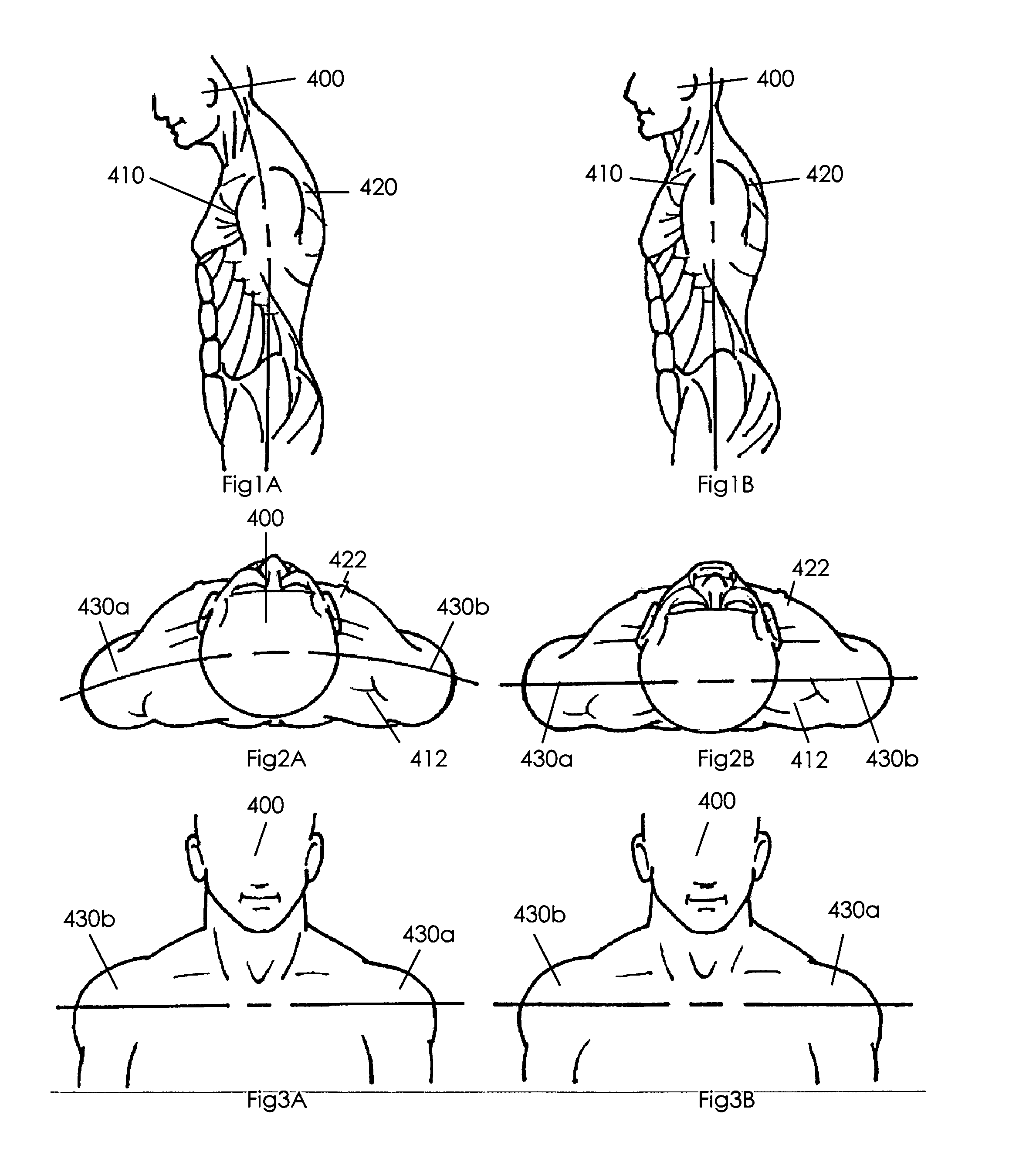 Method for torso muscle lengthening