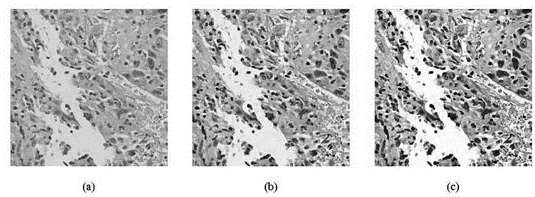 Method for improving pathology image visual effect based on main component analyzing