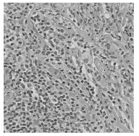 Method for improving pathology image visual effect based on main component analyzing