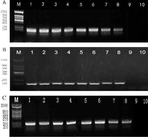 A set of real-time fluorescent quantitative PCR primers and probes and their kits for the identification of three species of short-bodied nematodes on sugarcane