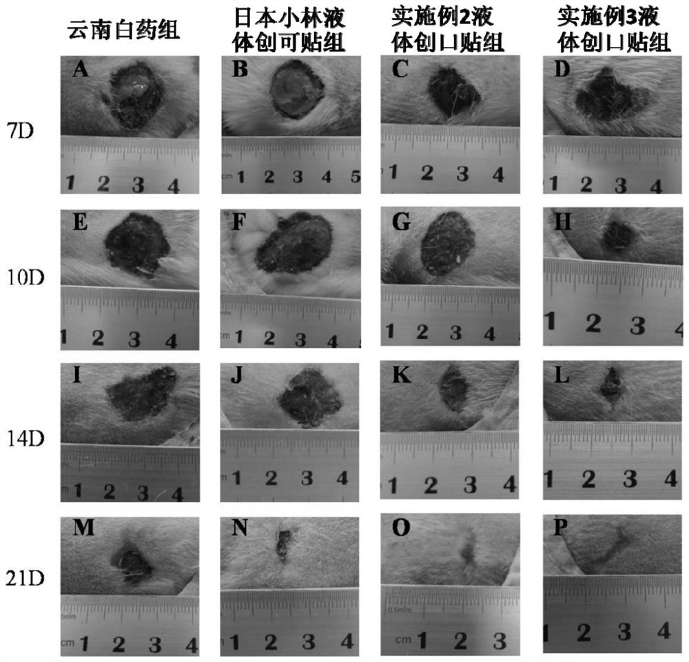 Liquid adhesive bandage and preparation method thereof