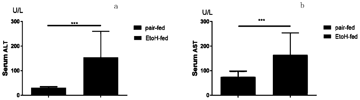miR-451a antisense strand inhibitor and application thereof