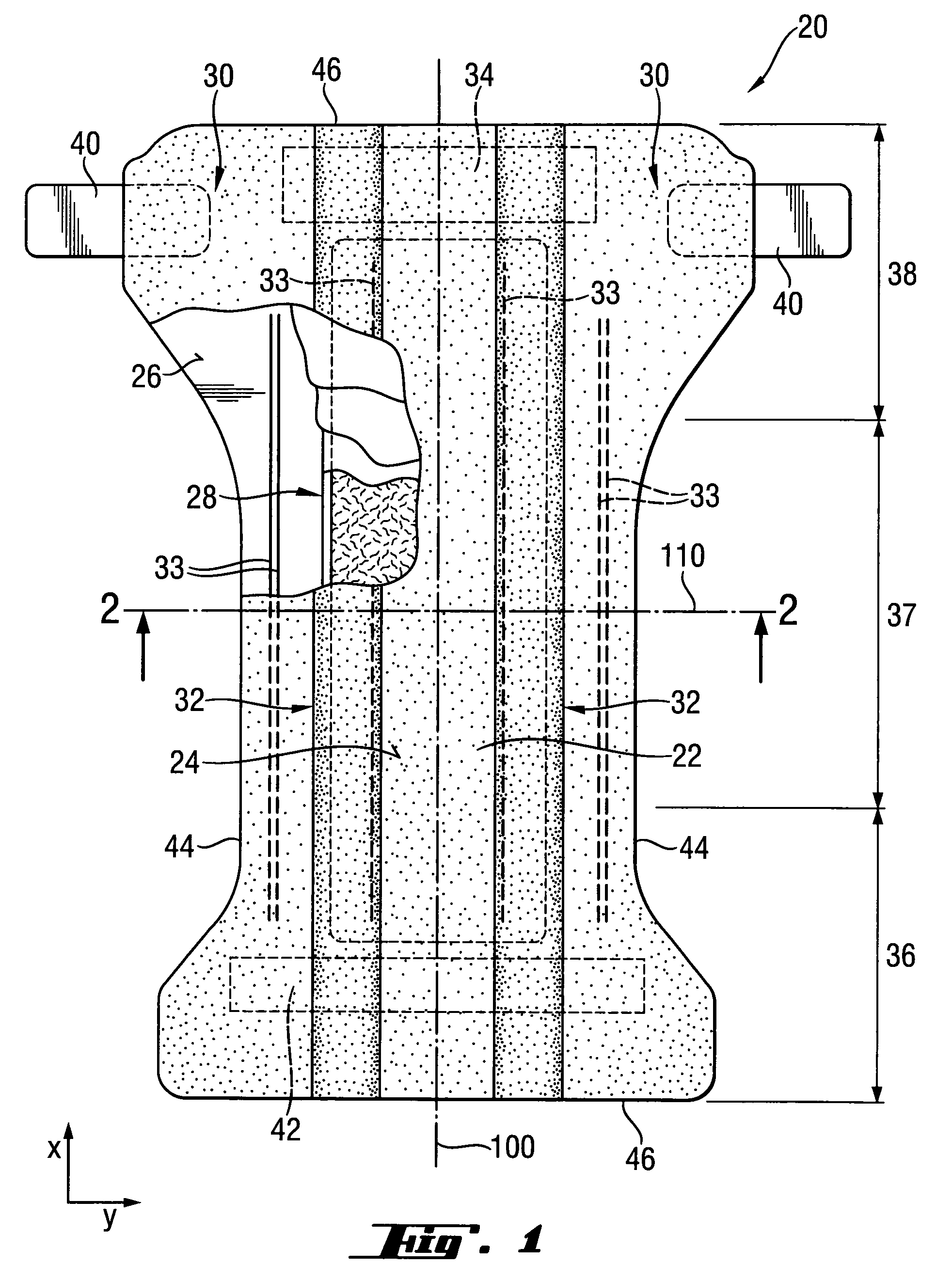 Process For Producing Sandwich Structures With Particulate Material Pattern