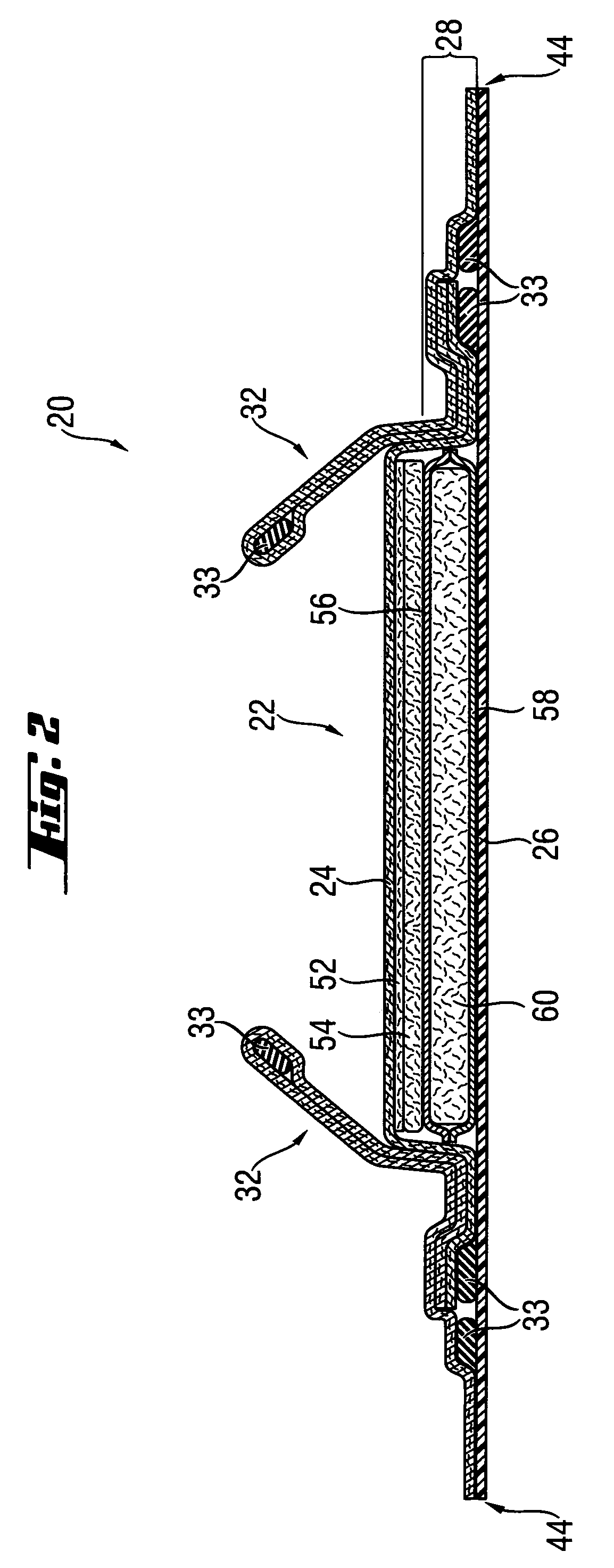 Process For Producing Sandwich Structures With Particulate Material Pattern