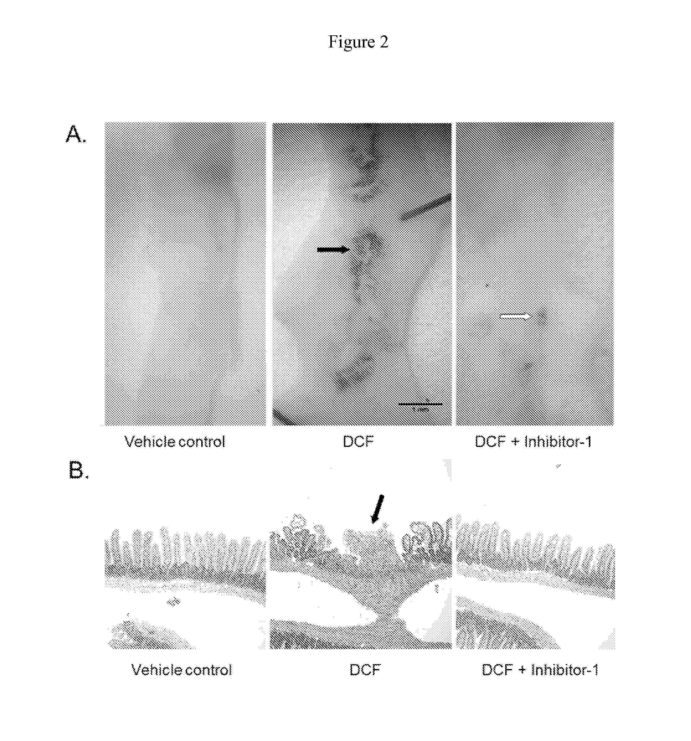 Methods of Treating Adverse Intestinal Effects of Non-Steroidal Anti-Inflammatory Drugs