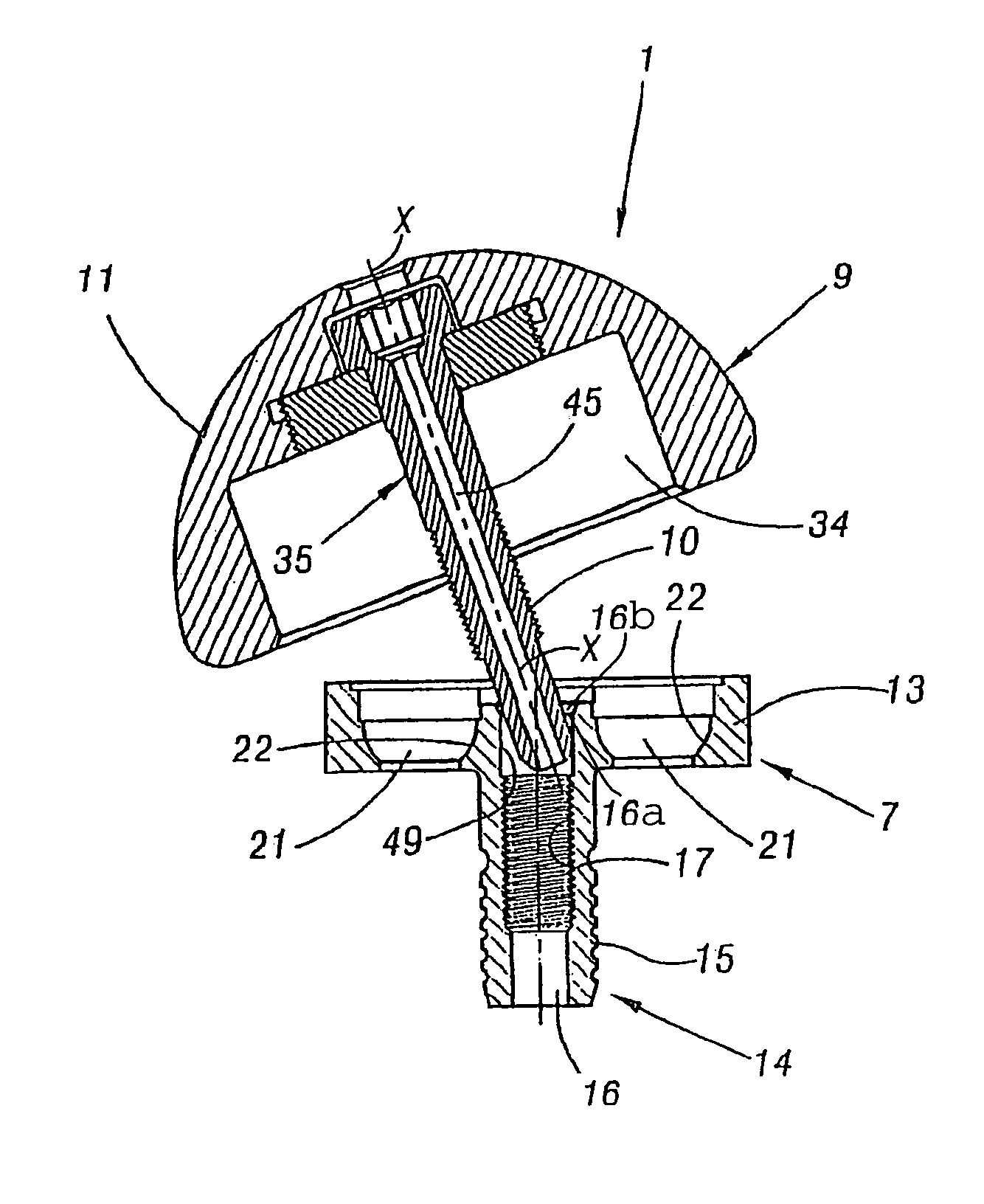 Shoulder prosthesis assembly