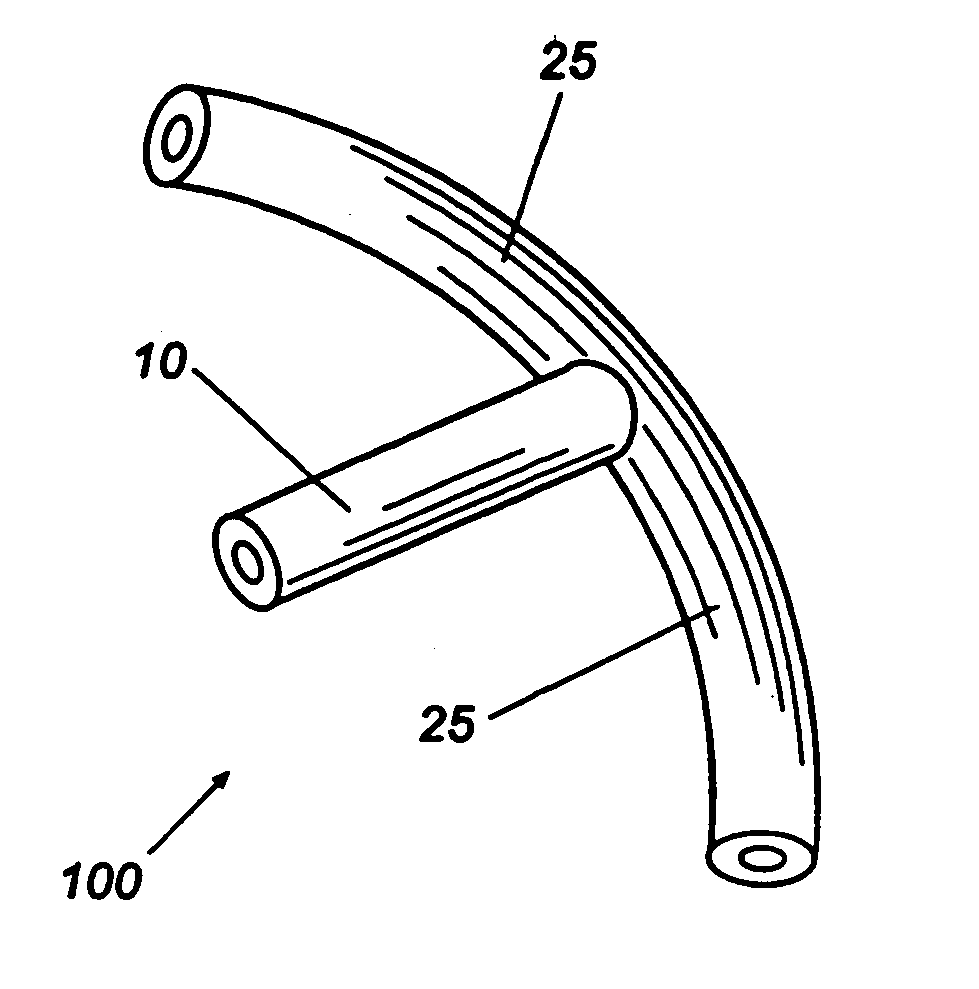 Shunt device and method for treating glaucoma