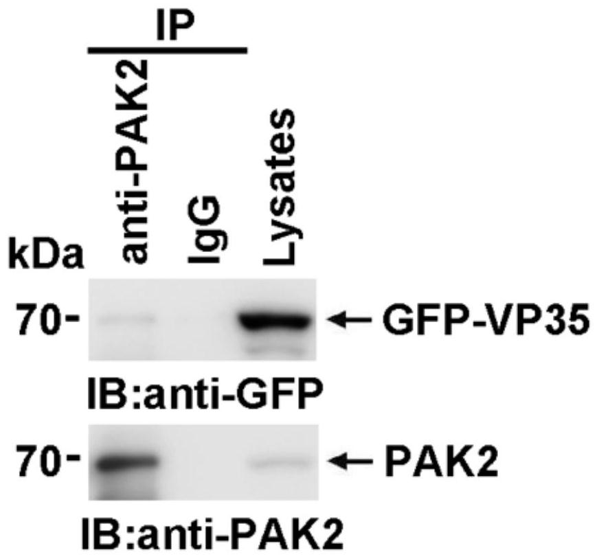 Application of FRAX597 compound in preparation of medicine for treating Ebola virus disease