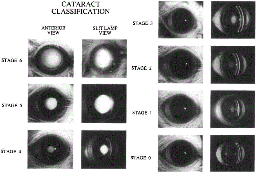 Ocular preparation for preventing and treating cataract and preparation method of ocular preparation