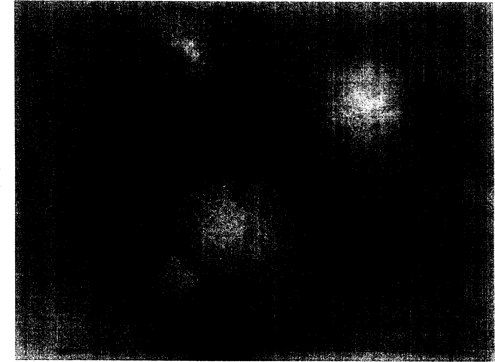 Method for producing resolvable hollow deformed foam aluminium alloy by secondary foaming