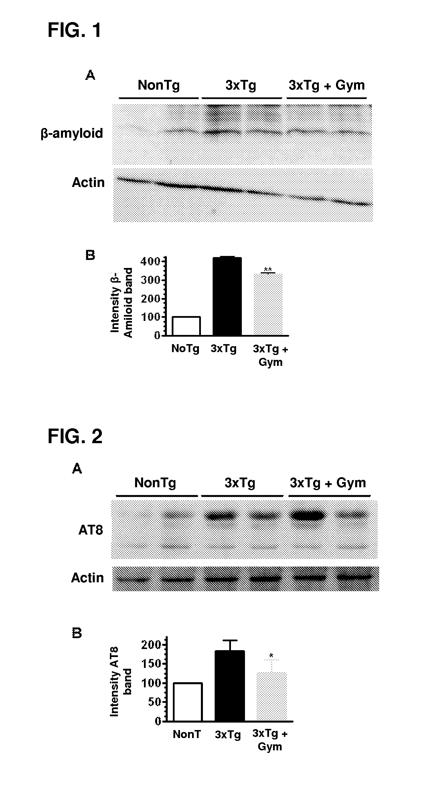 Use of gymnodimine, analogues and derivatives for the treatment and/or prevention of neurodegenerative diseases associated with tau and b-amyloid