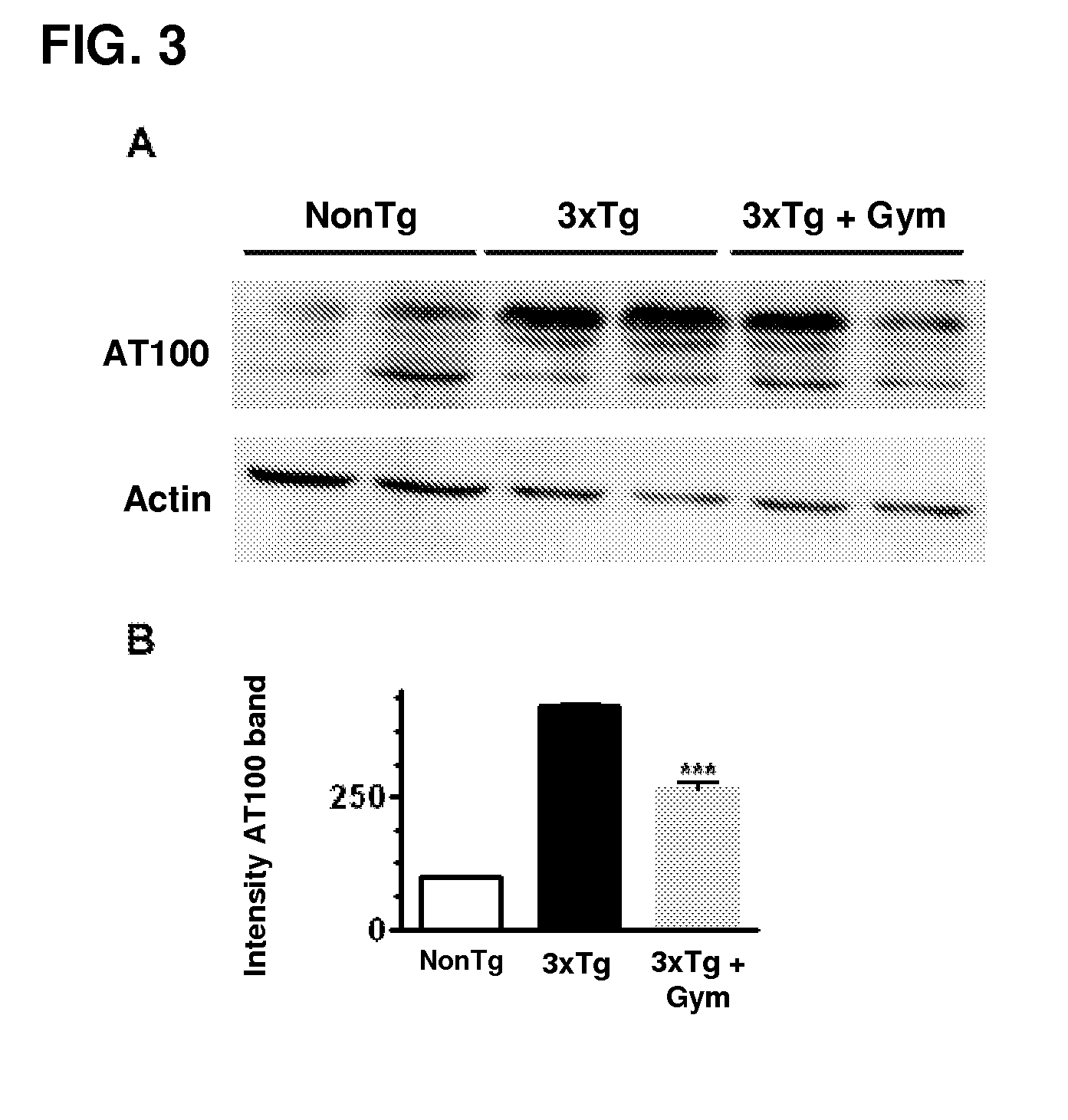 Use of gymnodimine, analogues and derivatives for the treatment and/or prevention of neurodegenerative diseases associated with tau and b-amyloid