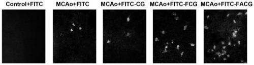 A synthetic peptide to treat brain damage