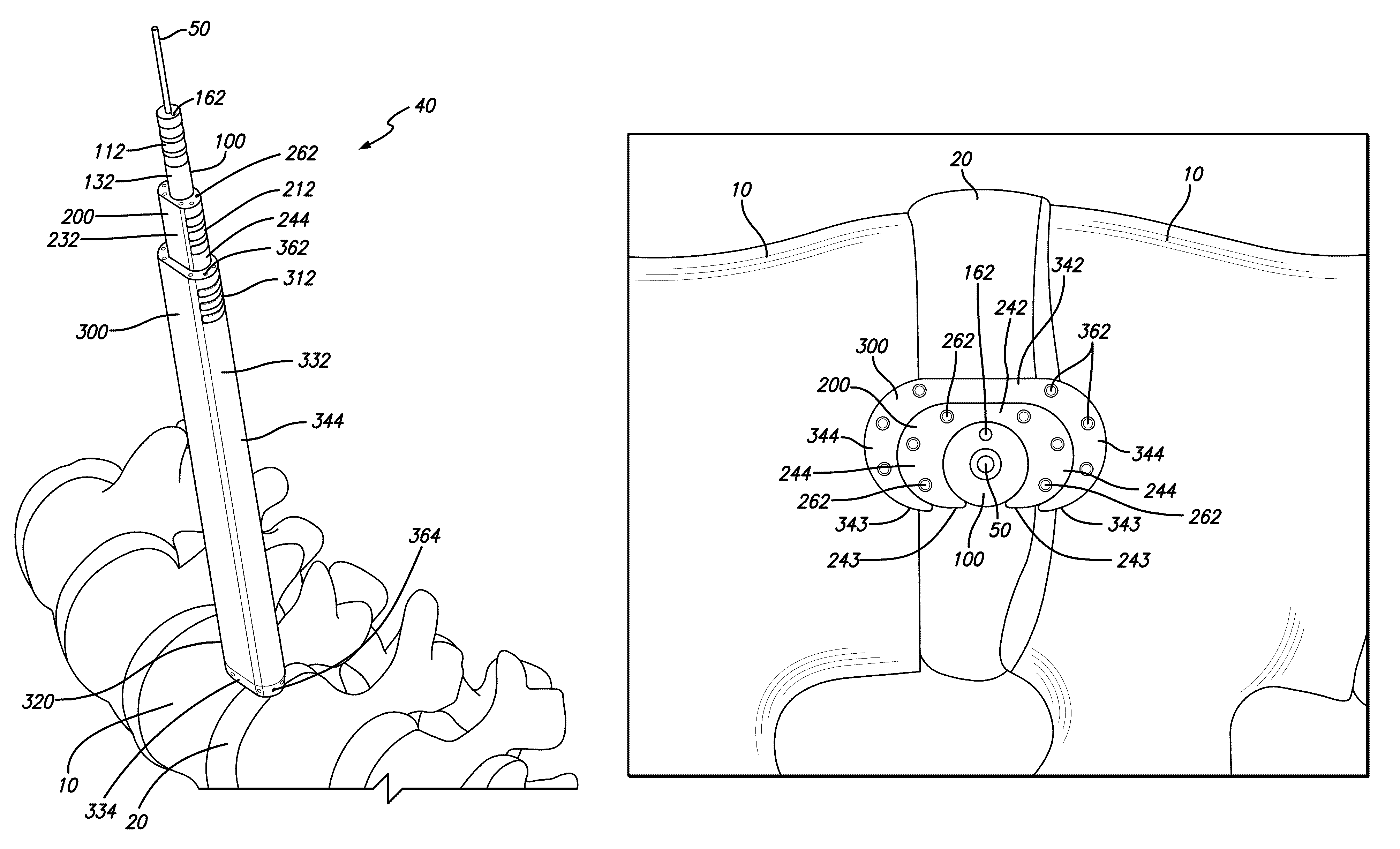 Tissue dilator and retractor system and method of use