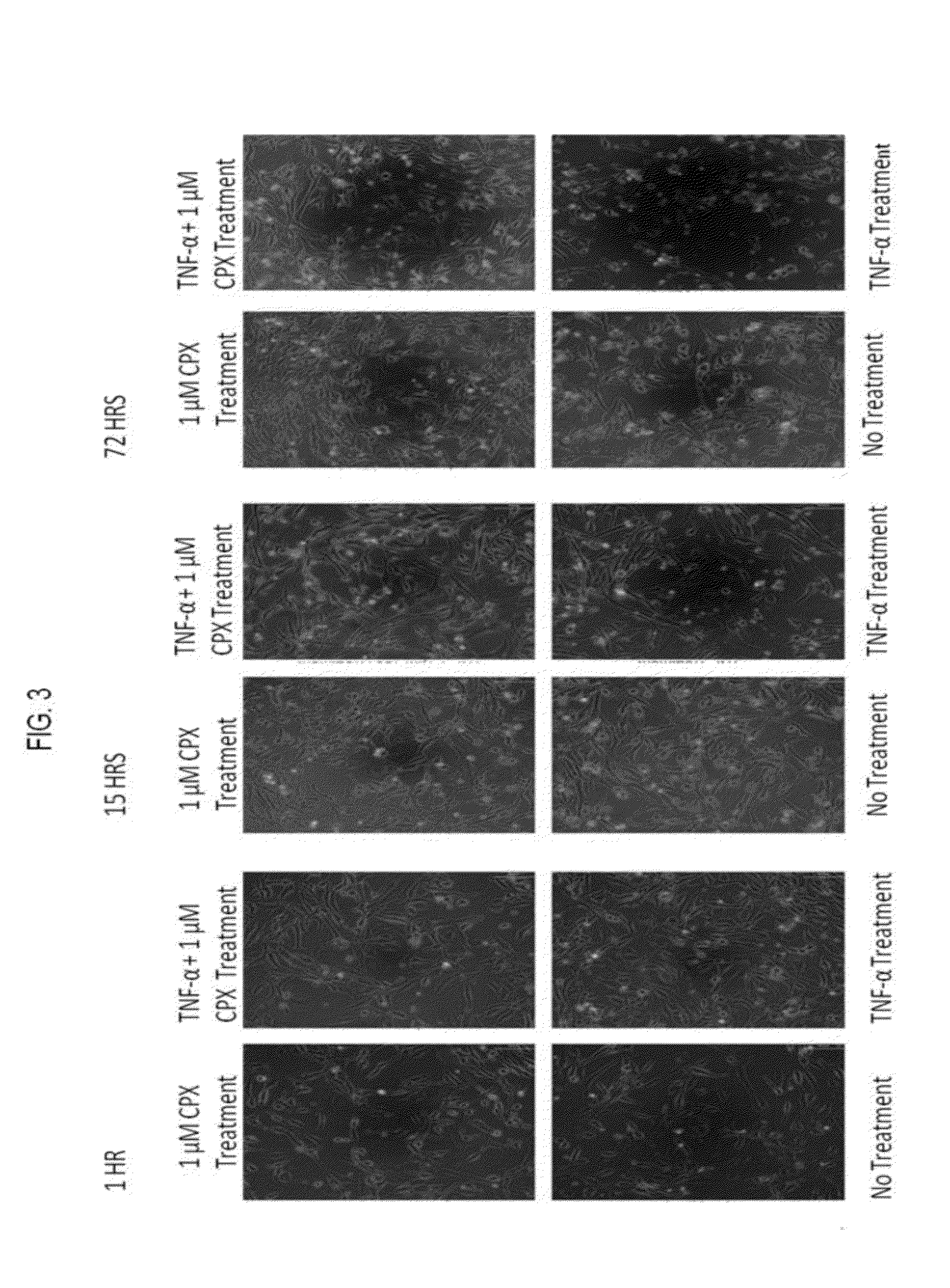 Hydroxypyridone derivatives, pharmaceutical compositions thereof, and their therapeutic use for treating inflammatory, neurodegenerative, or immune-mediated diseases