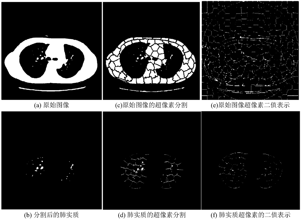 A medical image registration method based on super pixel guide