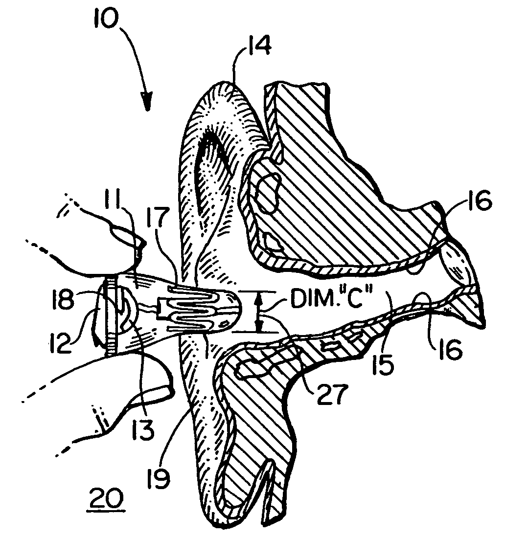 Self forming in-the-ear hearing aid